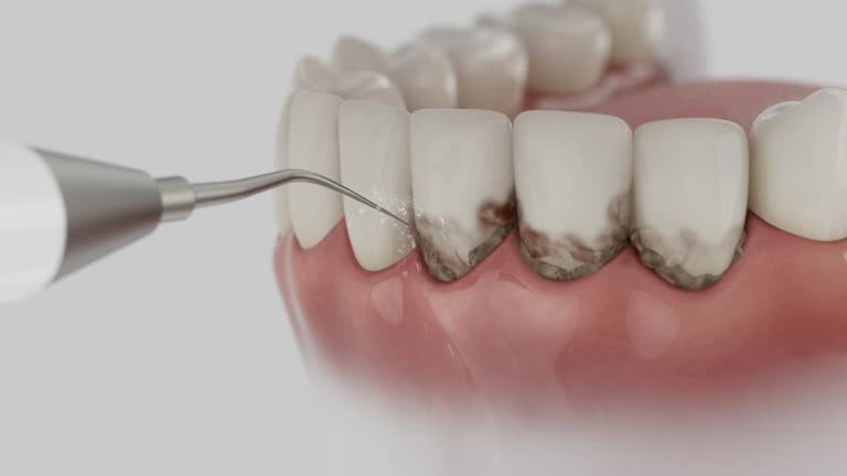 Trusted Tooth Extraction service in Houghton, NY - Dentist Open Now